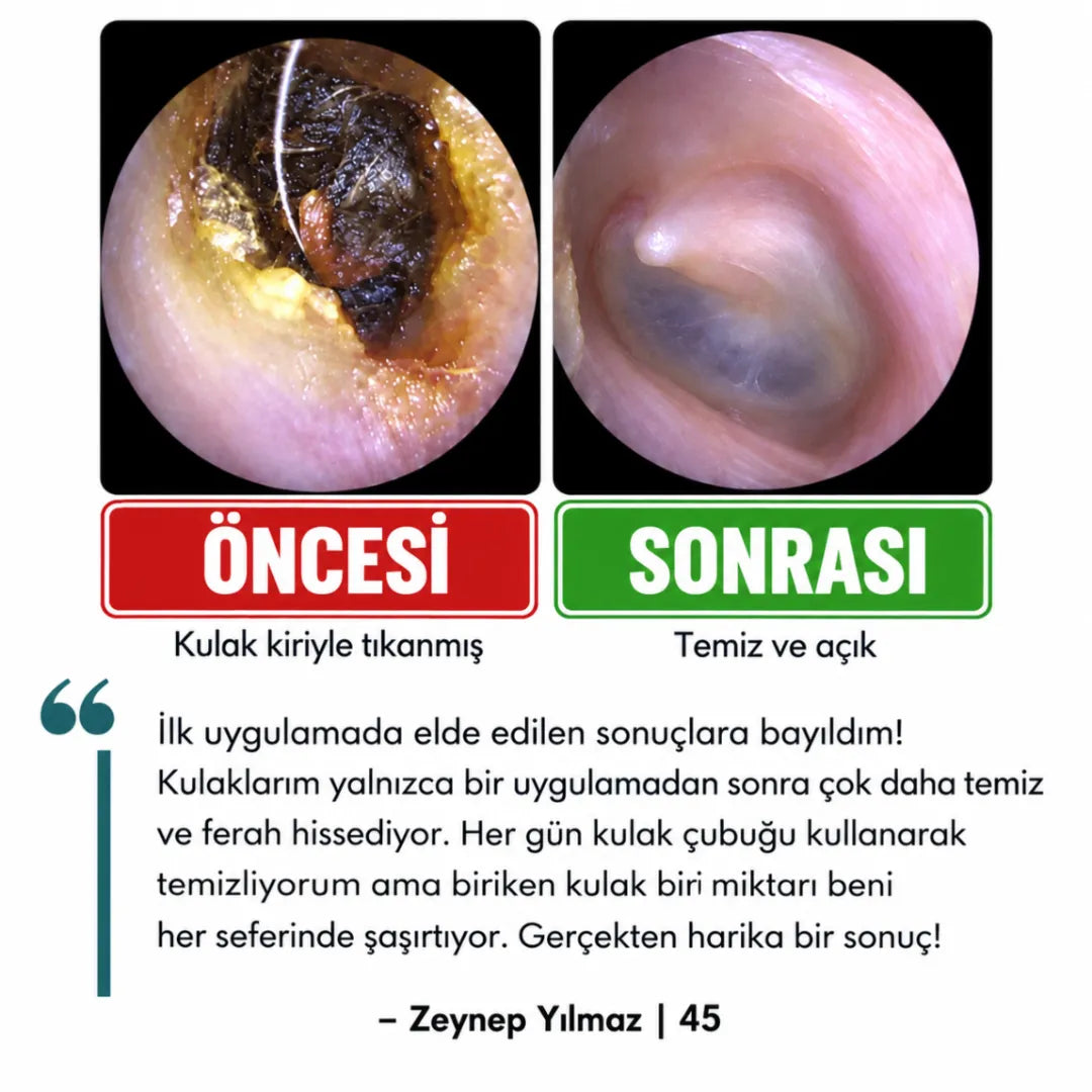 Altın Kuş® Yapışkan Uçlu Kulak Temizleme Çubuğu
