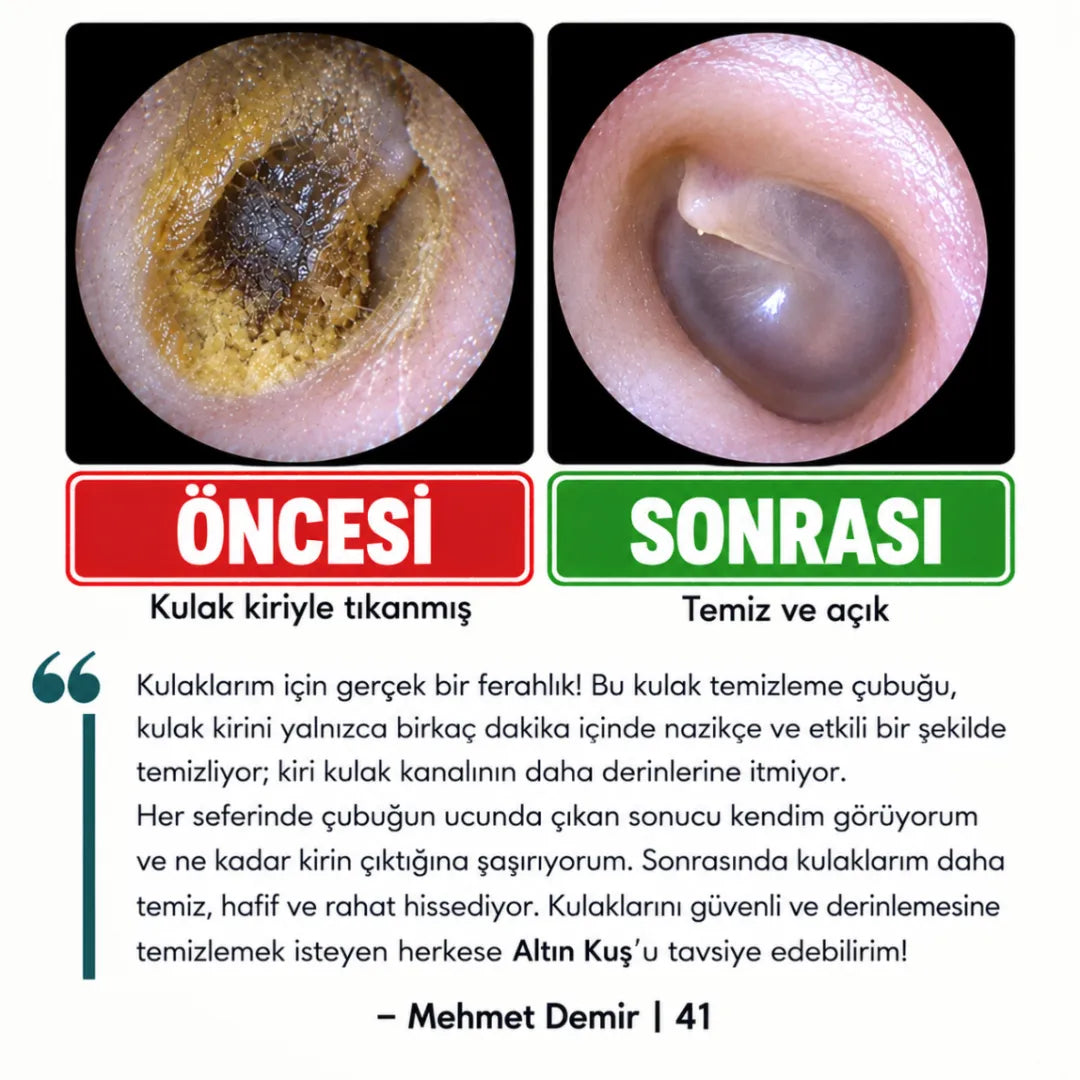 Altın Kuş® Yapışkan Uçlu Kulak Temizleme Çubuğu