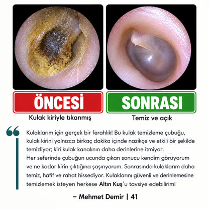 Altın Kuş® Yapışkan Uçlu Kulak Temizleme Çubuğu