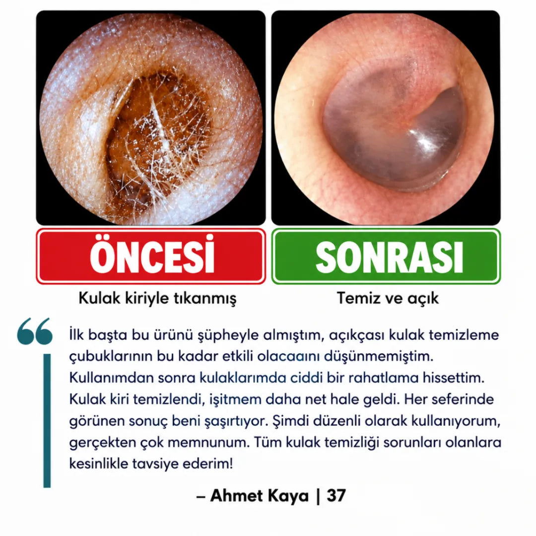Altın Kuş® Yapışkan Uçlu Kulak Temizleme Çubuğu