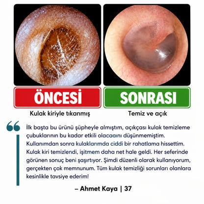 Altın Kuş® Yapışkan Uçlu Kulak Temizleme Çubuğu